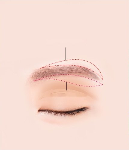 눈썹 위와 아래를 따라 붉은 점선으로 절개 위치를 표시한 눈썹거상술 절개선 일러스트