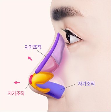 인공 보형물 없이 자가조직만으로 콧대와 코끝을 세운 옆얼굴 단면 일러스트 (도해 표기: 자가조직, 자가조직, 자가조직)