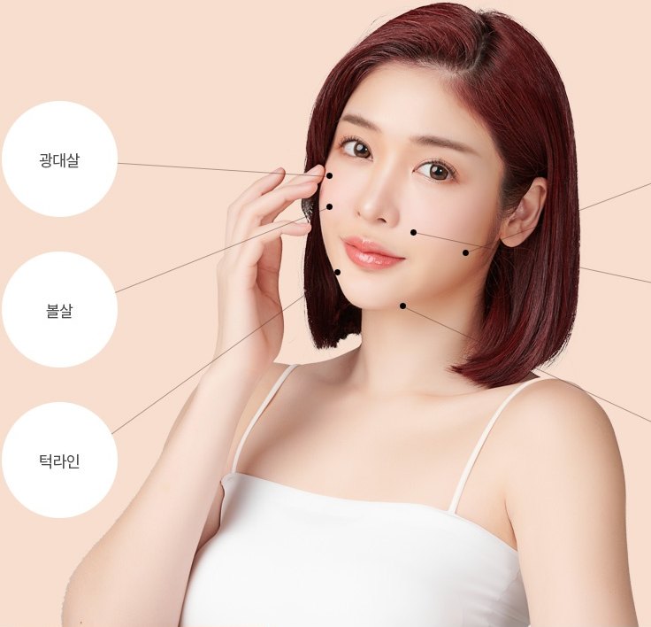 얼굴 지방흡입 부위를 표시한 여성 모델