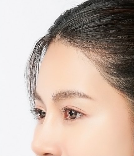 여성 모델의 이마와 헤어라인을 보여주는 측면 클로즈업