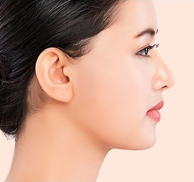 수술 후 — 얼굴의 처짐과 주름이 개선된 좌측 프로필
