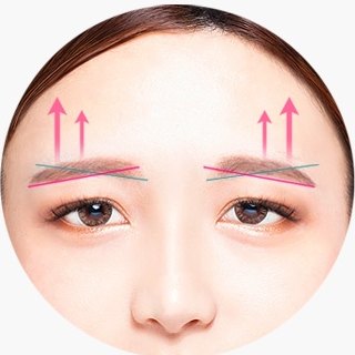 처진 눈꺼풀에 분홍 화살표가 표시된 눈매 도해