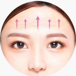 이마 주름 위로 분홍 화살표가 올라가는 이마 도해