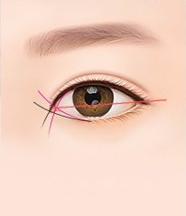 한쪽 눈 일러스트에 몽고주름과 눈꼬리 각도를 나타내는 분홍·검정 지시선이 교차한 그림
