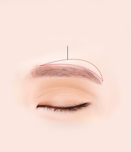 눈썹과 감은 눈을 그린 일러스트. 눈썹 라인 바로 위에 빨간 점선으로 절개 위치를 표시했다.