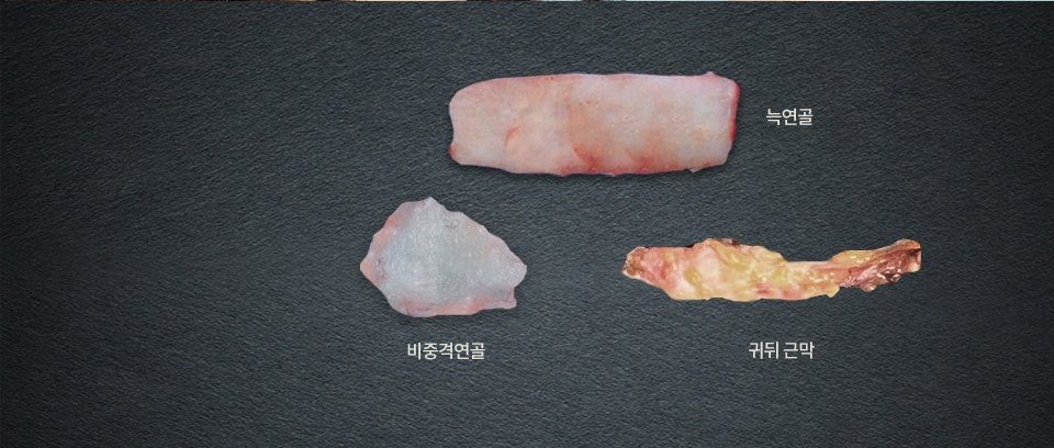 검은 슬레이트 위에 놓인 자가조직 검체 3점 — 늑연골, 비중격연골, 귀뒤 근막. 각 검체 옆에 이름이 표기되어 있다
