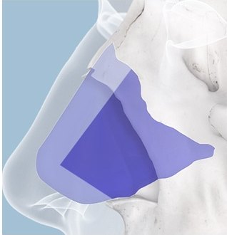 코 내부 골격 단면에 비중격연골 위치가 보라색으로 표시된 의학 일러스트