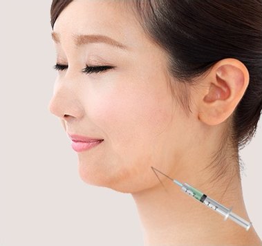 윤곽주사 시술 — 턱선 부위에 주사기를 대고 약물을 주입하는 장면