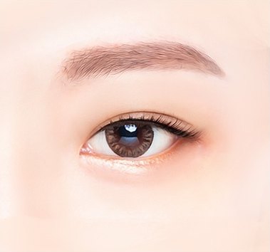 수술 후 — 또렷하게 떠진 눈과 정돈된 눈썹의 일러스트