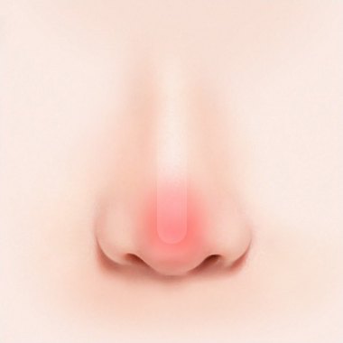 정면에서 본 코 3D 일러스트 — 코끝이 붉게 비치는 상태
