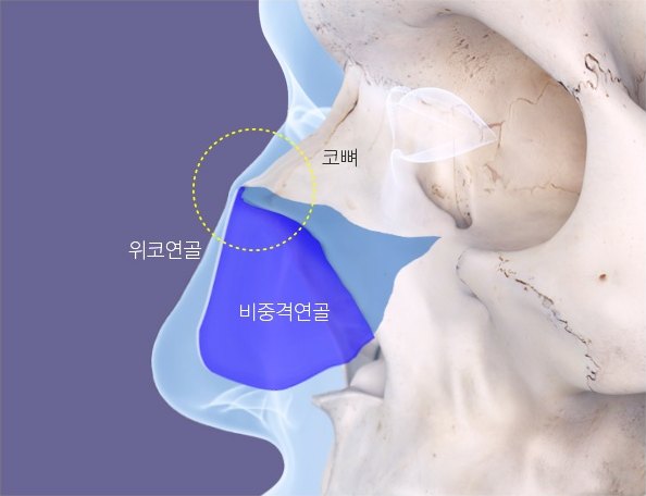 두개골 표본 위에 코뼈·위코연골·비중격연골을 색으로 표시한 해부 일러스트 (라벨: 코뼈, 위코연골, 비중격연골)