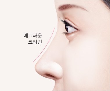 매끄러운 코라인이 된 수술 후 옆얼굴 일러스트 (라벨: 매끄러운 코라인)