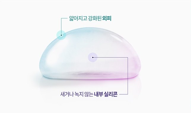 보형물 단면 도해 — 라벨 ‘얇아지고 강화된 외피’, ‘새거나 녹지 않는 내부 실리콘’