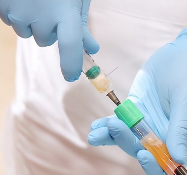 파란 장갑을 낀 손들이 주사기로 지방과 PRP를 혼합하는 장면