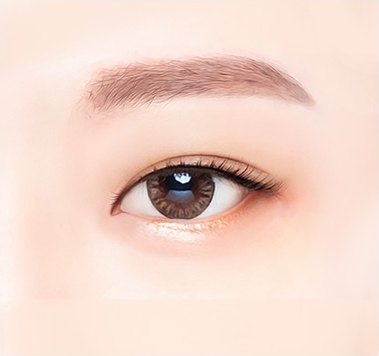앞트임 수술 후 커진 눈매 일러스트