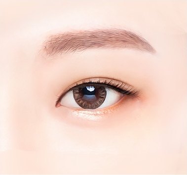 밑트임 수술 후 내려간 눈꼬리 일러스트