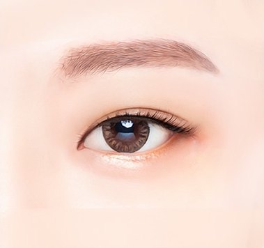 윗트임 수술 후 눈동자가 드러난 눈매 일러스트
