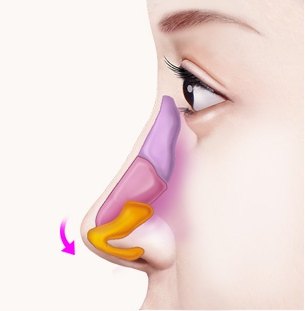 아래로 고정 — 콧날개를 아래로 내려 고정하는 과정 일러스트